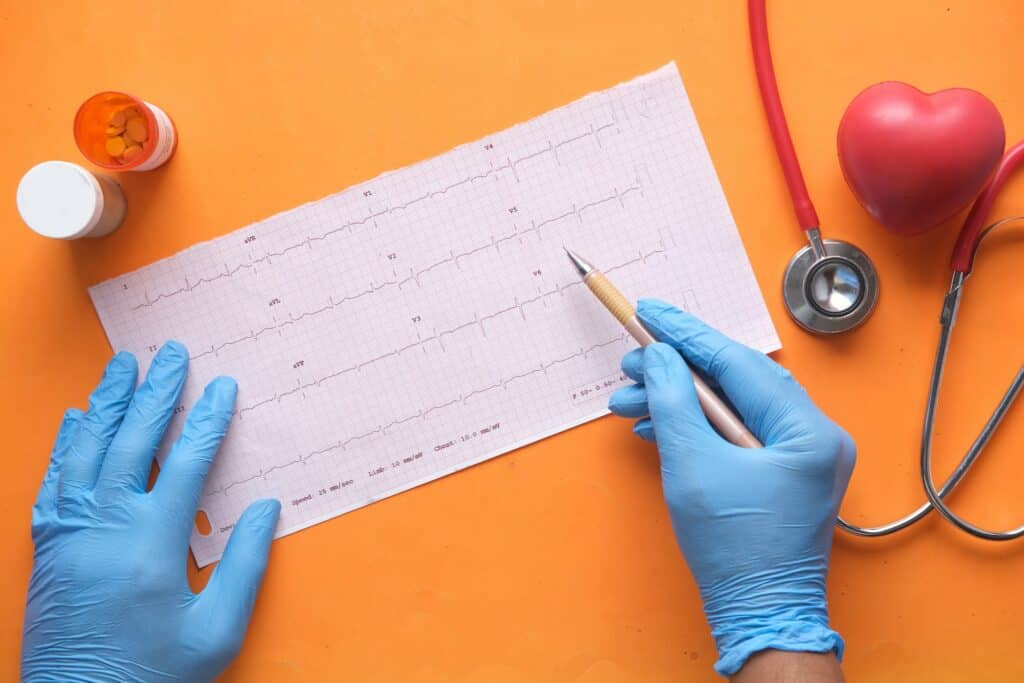 close nas mãos com luvas do médico escrevendo em um exame com um estetoscópio ao redor e uma bolinha em forma de coração